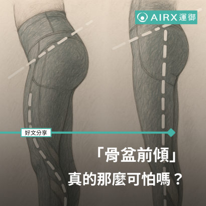 骨盆前傾真的那麼可怕嗎？.png